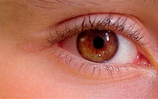 Глаукома может привести к полной слепоте – врач