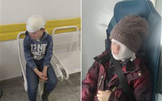 Двух детей госпитализировали после нападения собаки в ВКО