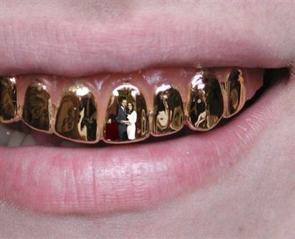 Золотые зубы станут новым трендом 2020 года