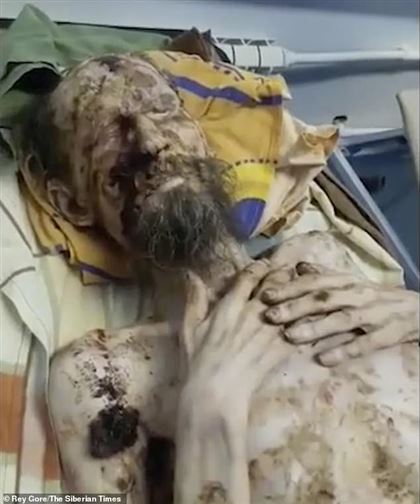 Жителя Актобе, страдающего псориазом, приняли за ожившую мумию индийского святого: что пишут о нас в иностранных СМИ