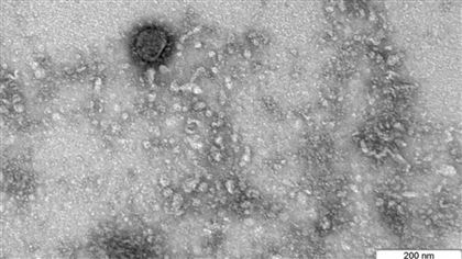 Ученые сделали снимок коронавируса под микроскопом