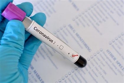 В РК зарегистрировали еще 12 случаев заражения коронавирусом