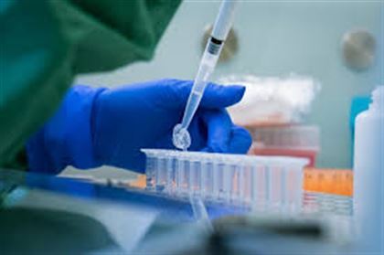 В РК зарегистрировано еще 9 случаев заражения коронавирусной инфекцией