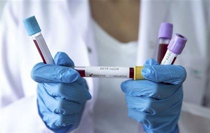 В РК зарегистрировали еще пять новых случаев заражения коронавирусом