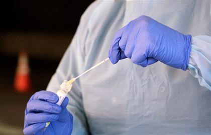 Французские медики назвали новые симптомы коронавируса