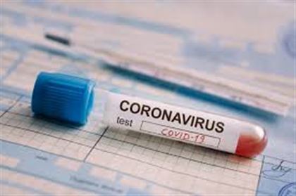 Количество зараженных коронавирусом в Казахстане перевалило за три тысячи человек