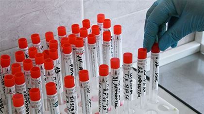 Бекшин озвучил, почему Алматы лидирует в стране по числу выявленных случаев коронавируса