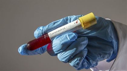 В РК за сутки коронавирусом заболели 363 человека