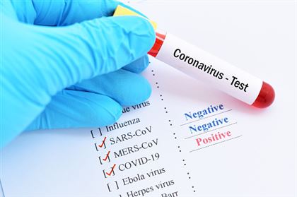 За прошедшие сутки в Казахстане выявлен 271 заболевший коронавирусом