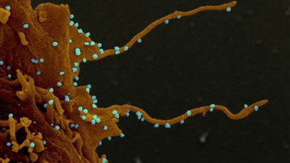 Как коронавирус тянет "зловещие щупальца" к здоровым клеткам