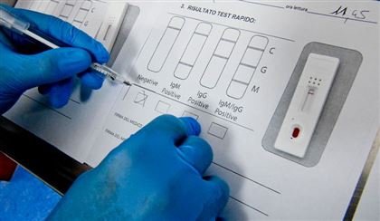 Миллиард тенге выделен на покупку тестов на коронавирус – минздрав РК