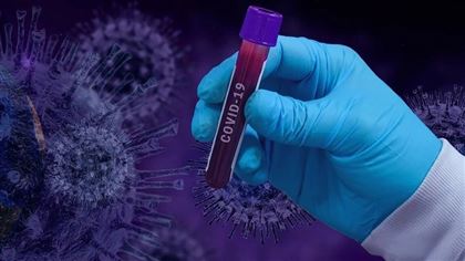 В РК за прошедшие сутки выявлены 1472 заболевших коронавирусом