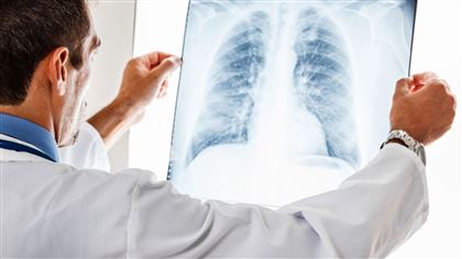 Зараженных пневмонией граждан РК будут реабилитировать выборочно