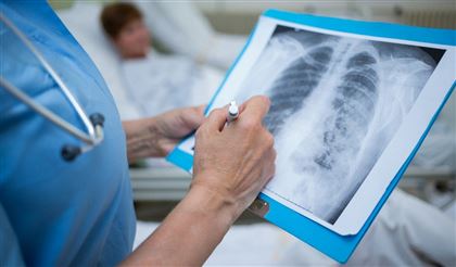 Еще 57 больных пневмонией зарегистрировали за сутки в РК