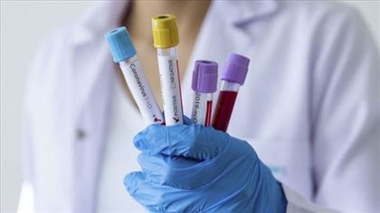 В РК за прошедшие сутки коронавирусом заболели 77 человек