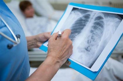 27 человек заболели пневмонией за прошедшие сутки в РК