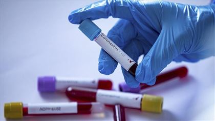 В РК за прошедшие сутки 73 человека заболели коронавирусом