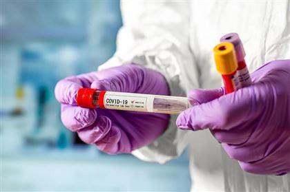 В РК за прошедшие сутки коронавирусом заболели 79 человек