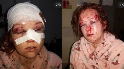 В Шымкенте мужчина жестоко избил бывшую сожительницу молотком во дворе ее дома