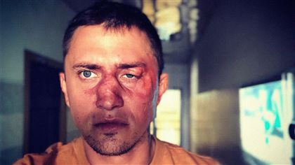 Друг Павла Прилучного рассказал подробности об избиении актера