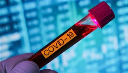 Сколько выявлено заболевших вирусом COVID-19 за последние сутки в РК