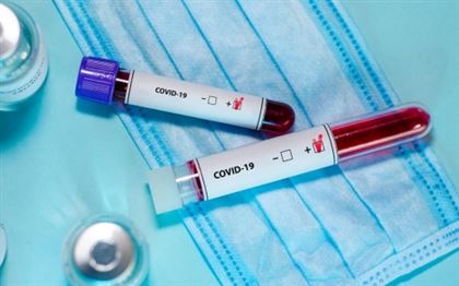 Сколько выявлено заболевших коронавирусом за последние сутки в РК