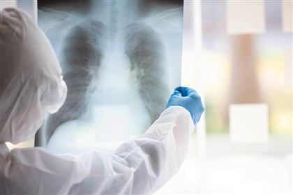 Сколько человек заболели пнвмонией за сутки в Казахстане