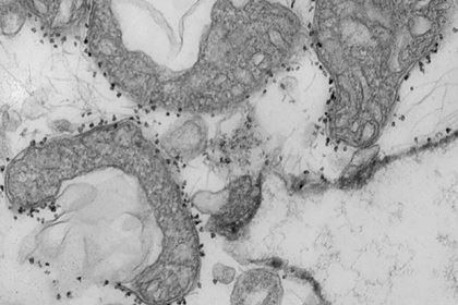 Ученые определили признак скорой смерти от коронавируса