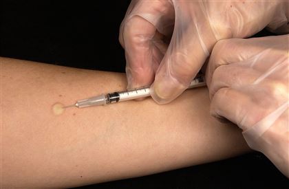 В Греции выявили пять случаев осложнения после вакцинации