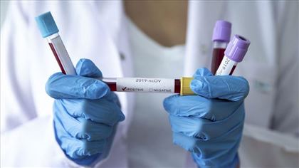 В Казахстане выявили ещё 2077 больных коронавирусом