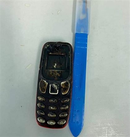Житель Кызылорды проглотил мобильный телефон
