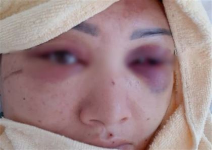 В Кызылорде мужчина избил заболевшую коронавирусом жену и выгнал ее на улицу