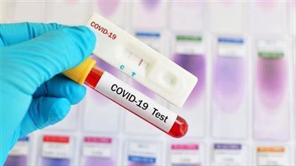 Ученые раскрыли цель новой мутации коронавируса SARS-CoV-2