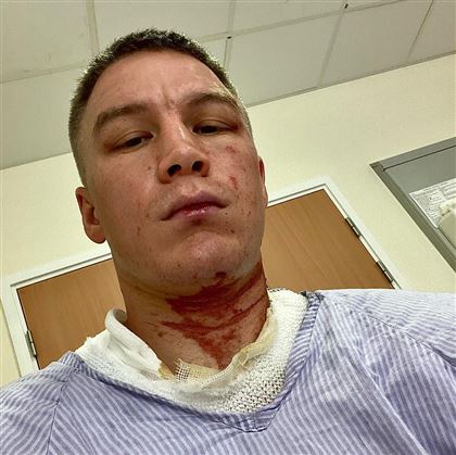 "Несколько дней я провёл в больнице, с ожогами" - боксер Виктор Коточигов пережил нападение на сборах в Англии