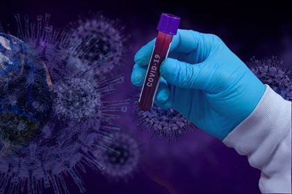 Неожиданный фактор тяжелого течения коронавируса назвали ученые