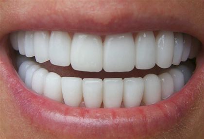 Нутрициолог посоветовала дешевый способ улучшить состояние зубов