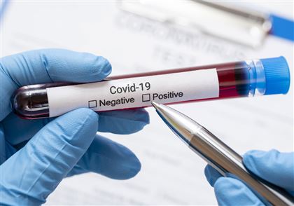 В РК за последние сутки коронавирусом заболели 946 человек