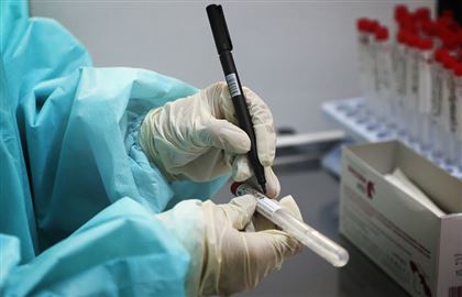В Казахстане за прошедшие сутки коронавирусом заболели 751 человек