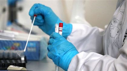 В РК за прошедшие сутки коронавирусом заболели 416 человек