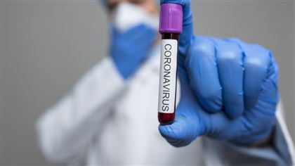 В РК за прошедшие сутки коронавирусом заболели 483 человека