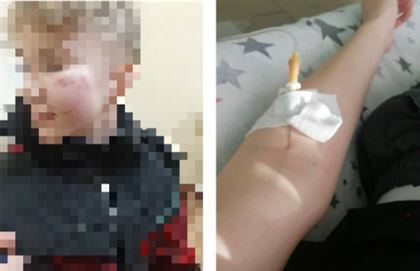 В Экибастузе семиклассник попал в больницу с черепно-мозговой травмой после избиения в школе