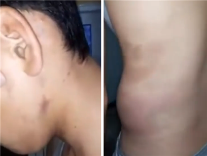 14-летнего мальчика жестоко избила толпа старшеклассников