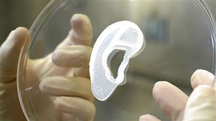 В США пациентке пересадили напечатанное на 3D-принтере ухо