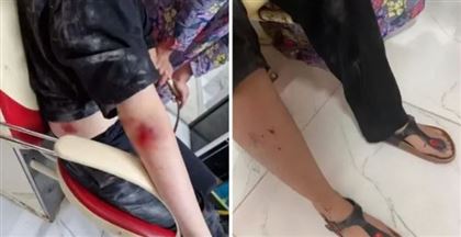 В Жанаозене бездомные собаки напали на девочку