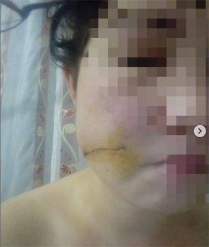 В Павлодаре муж нанёс жене пять ножевых ранений