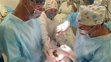 Более килограмма волос извлекли хирурги из желудка ребенка в Жамбылской области