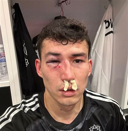 Футболист, разбивший лицо Зайнутдинову, заявил о расизме